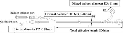 Initial Experience in Transvenous Implantation of a Left Ventricular Lead With a Novel Venogram Balloon Catheter